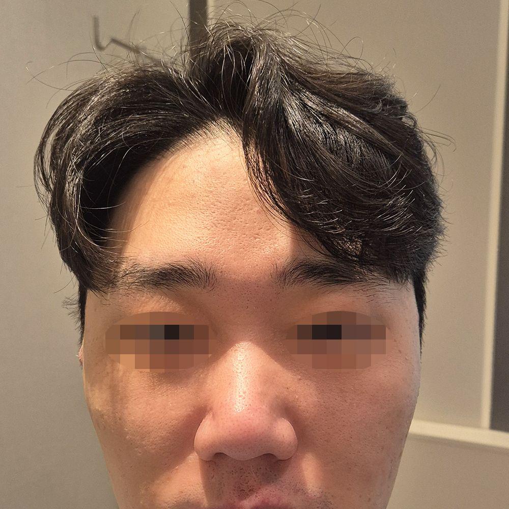 後