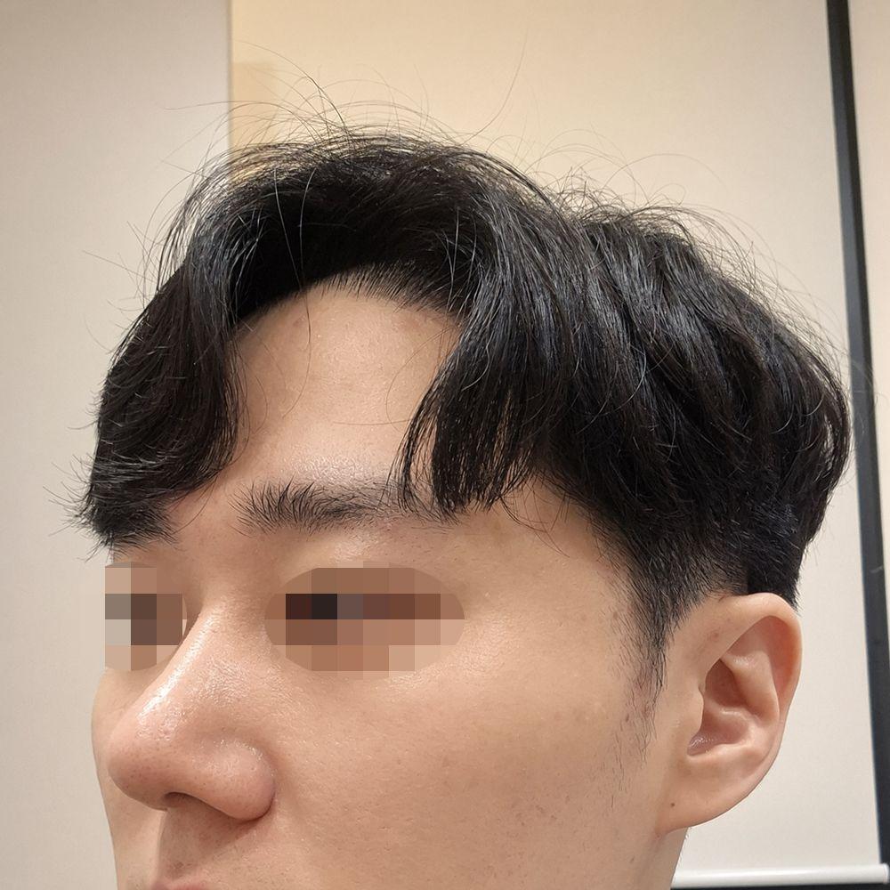 後