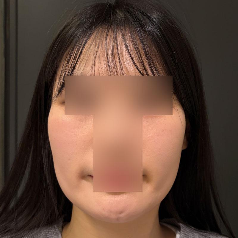 前