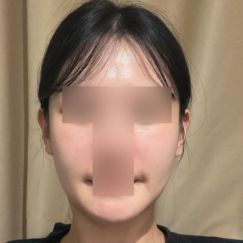 后