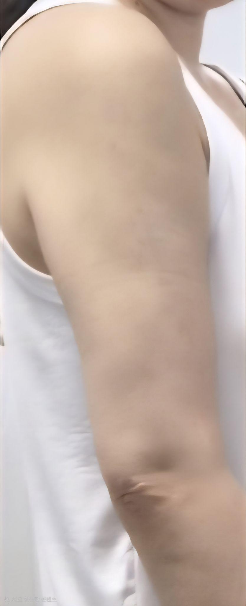 後