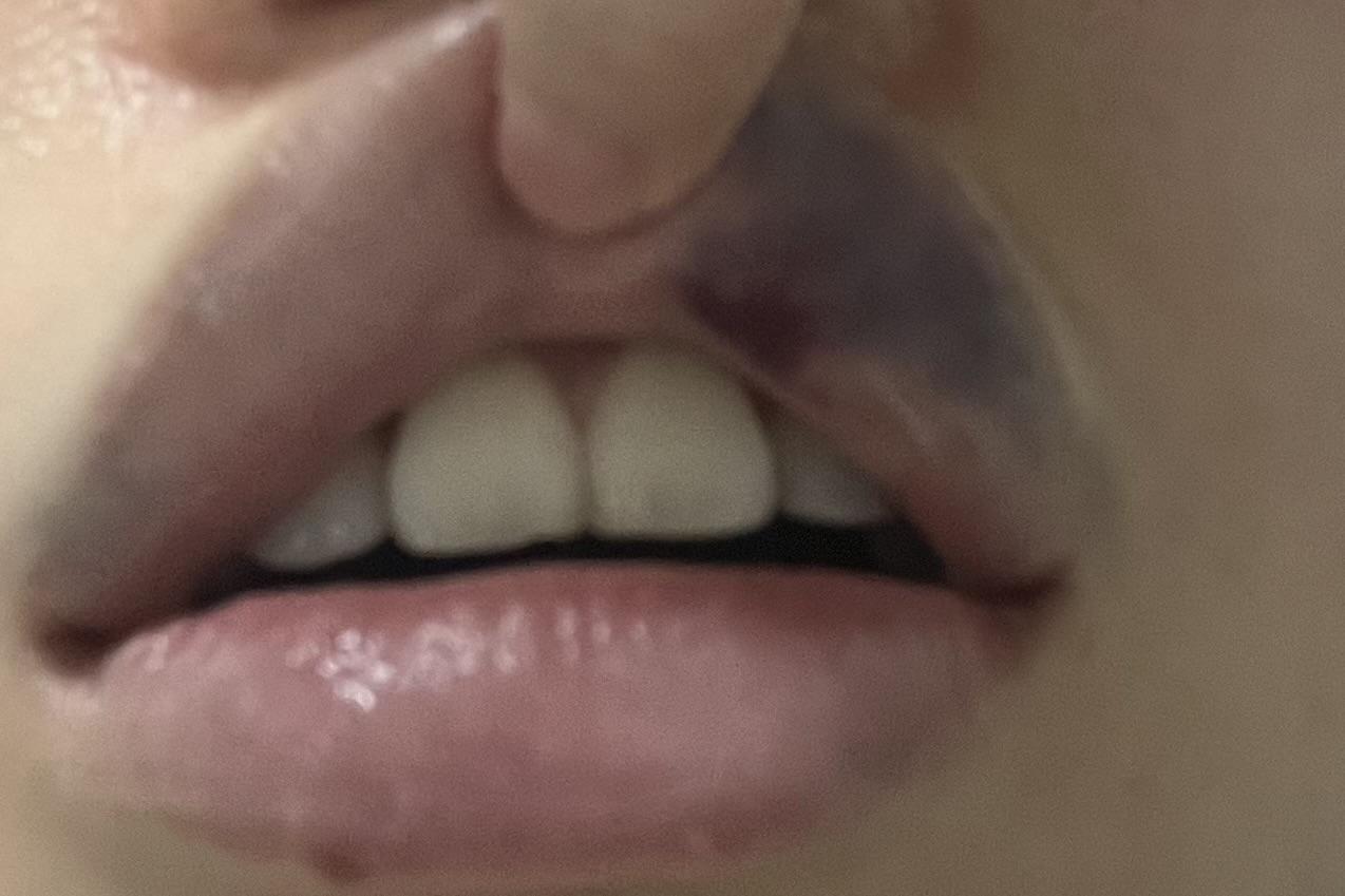 後