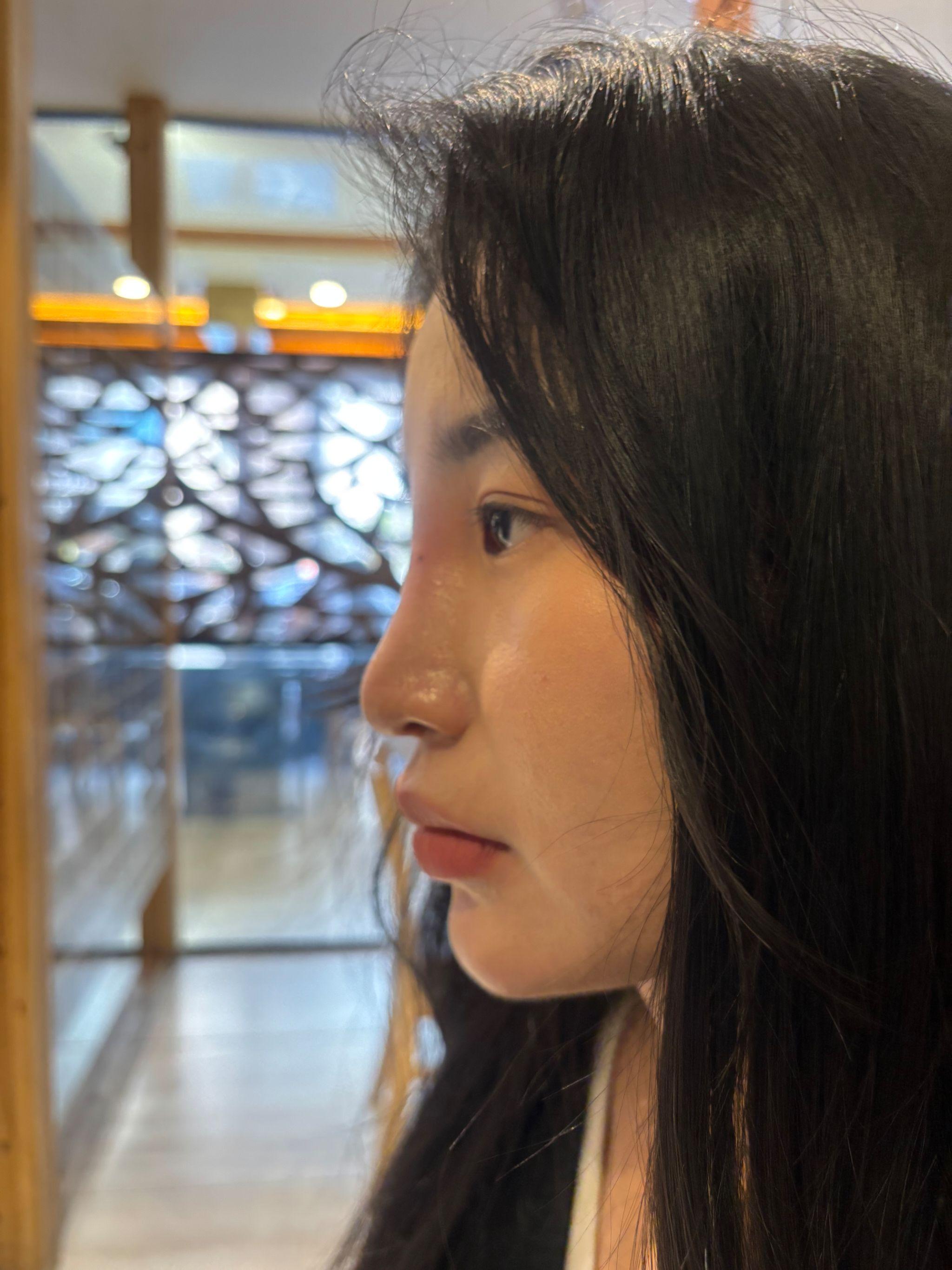 後