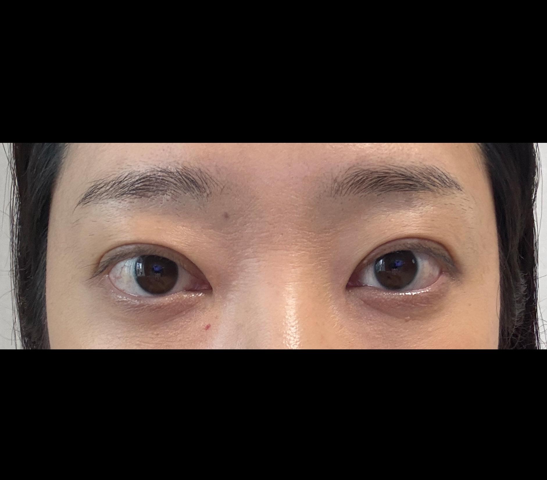 后