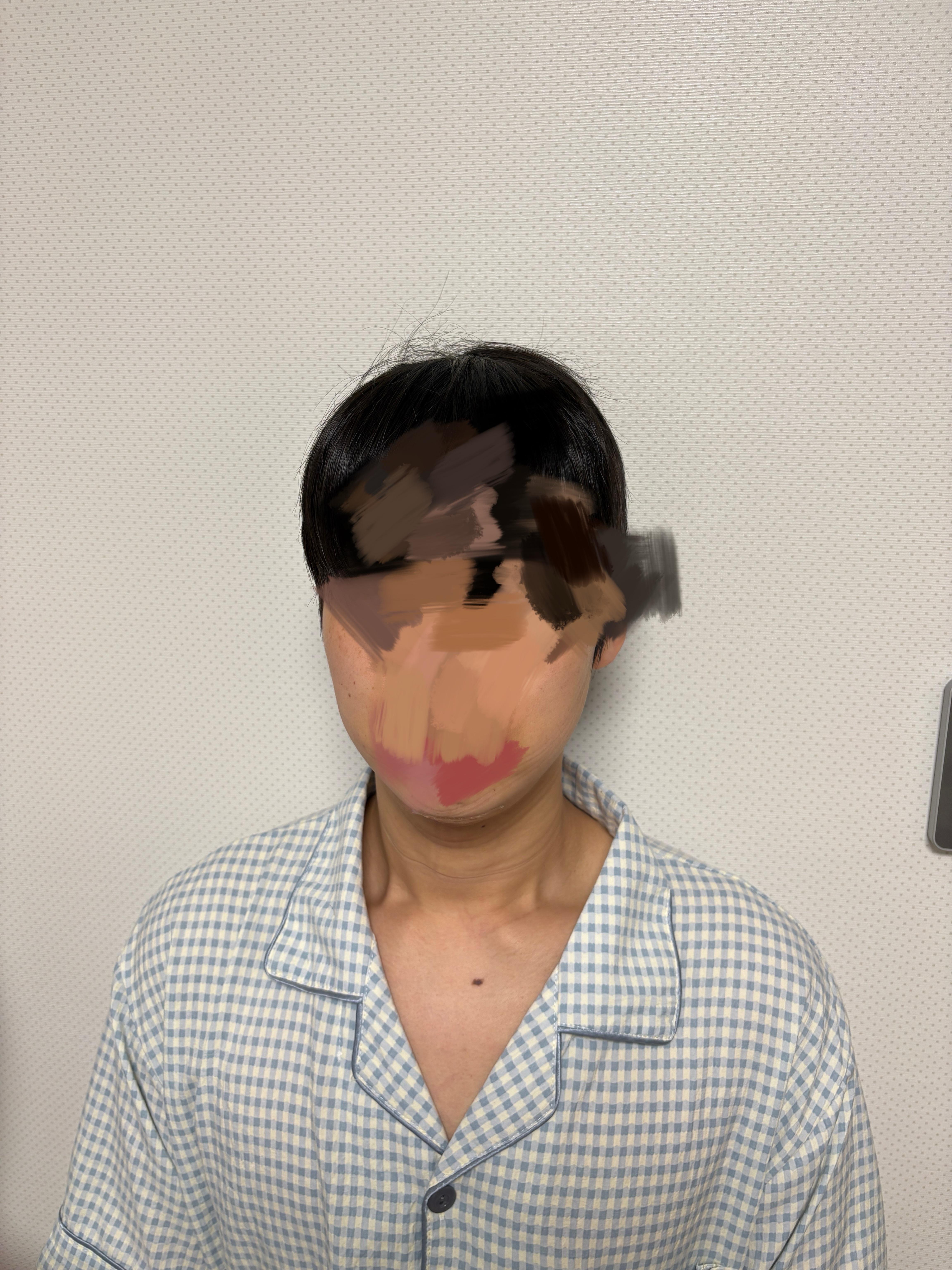 後