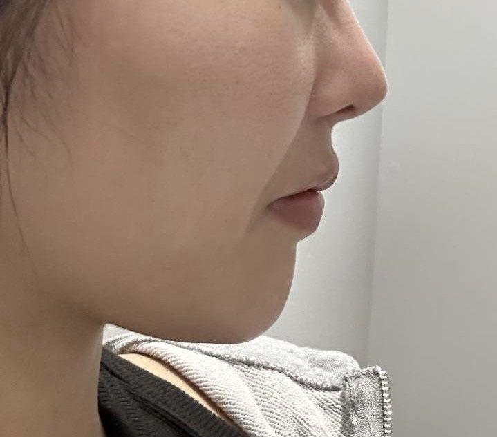 後