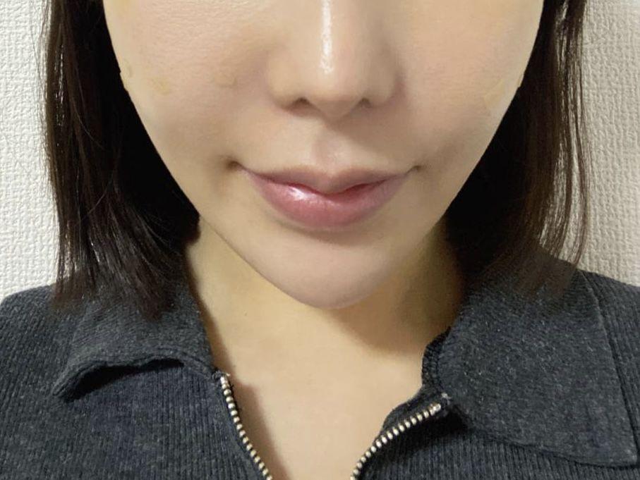 後
