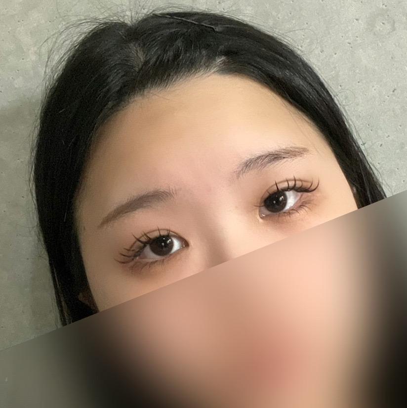 後