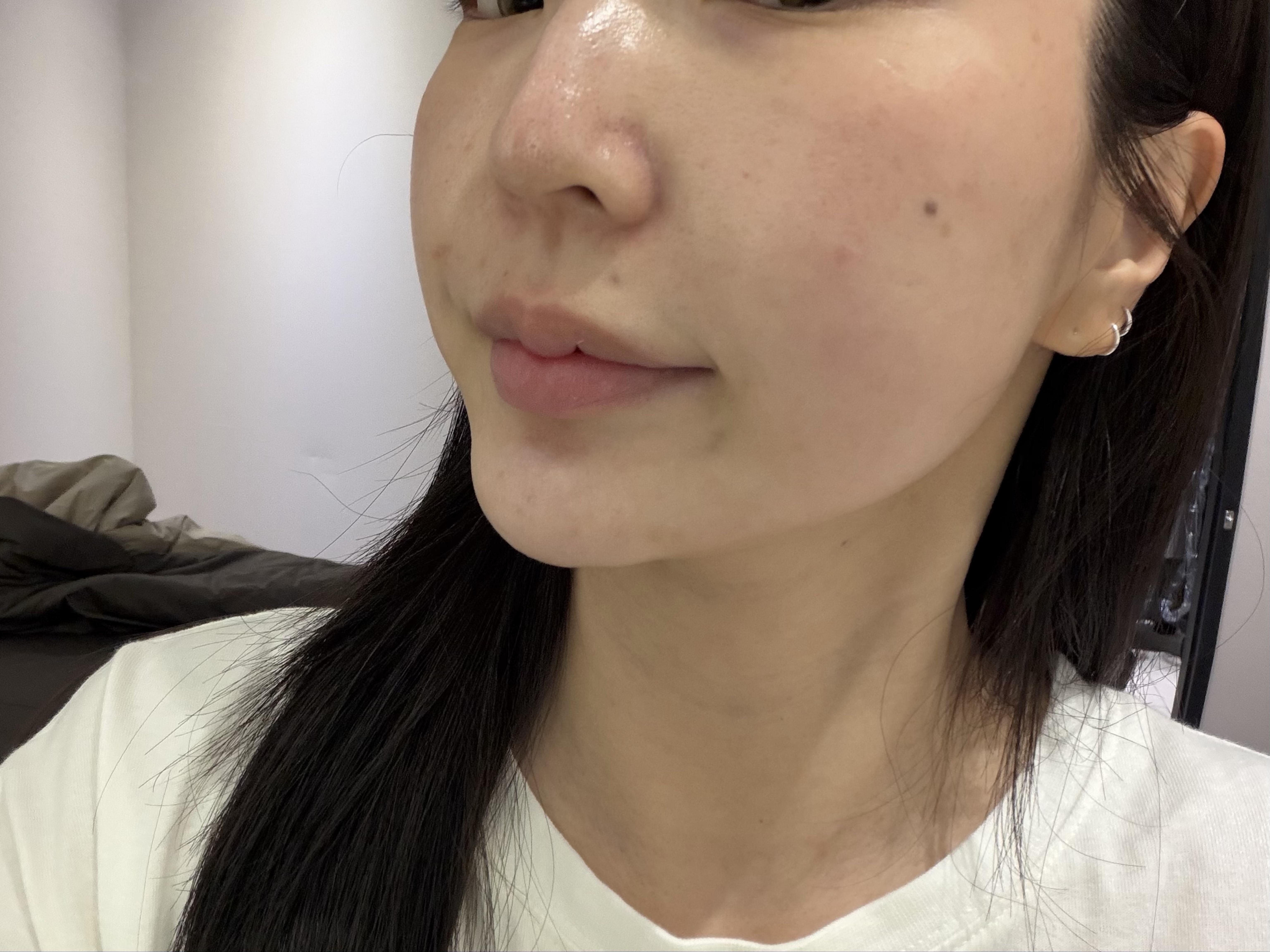 後