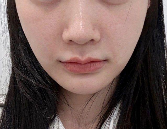 後
