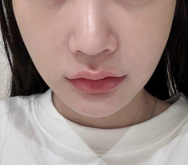 後
