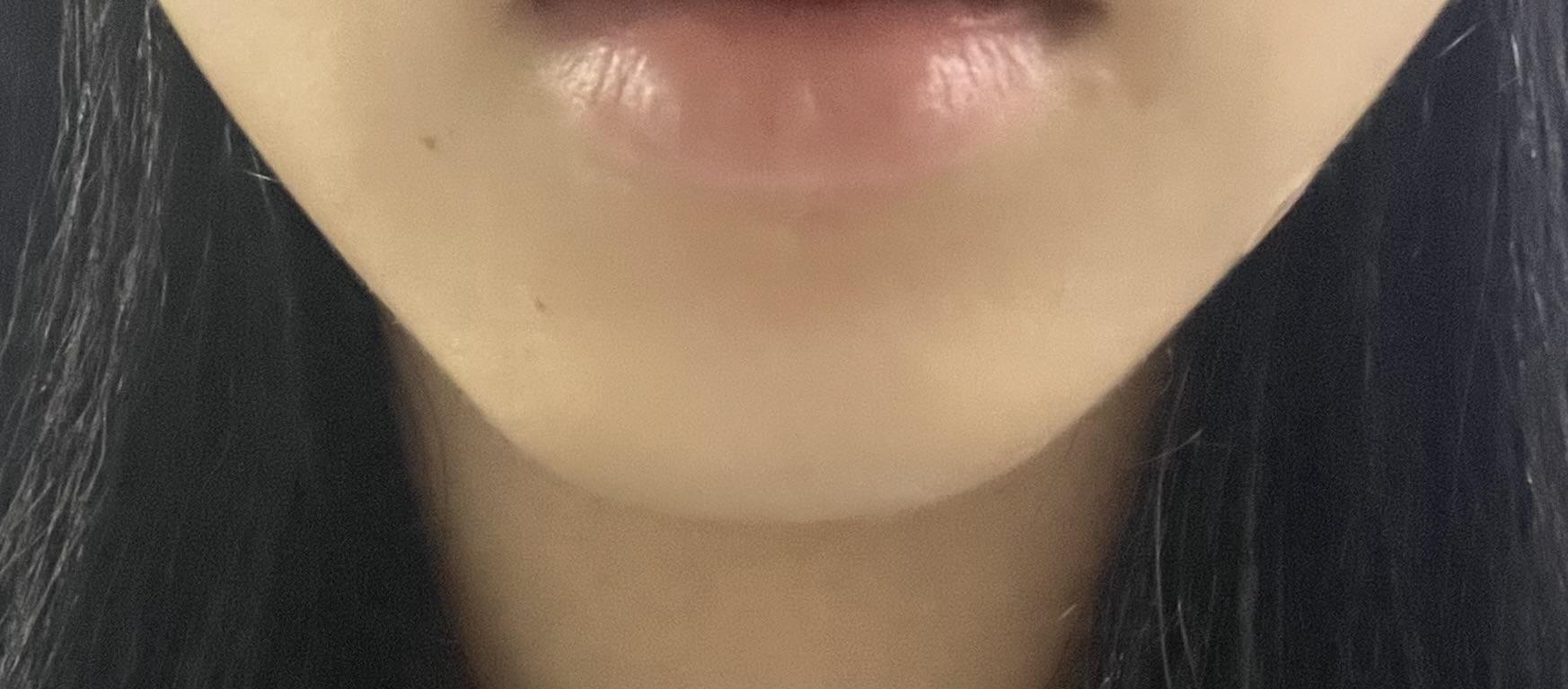 後
