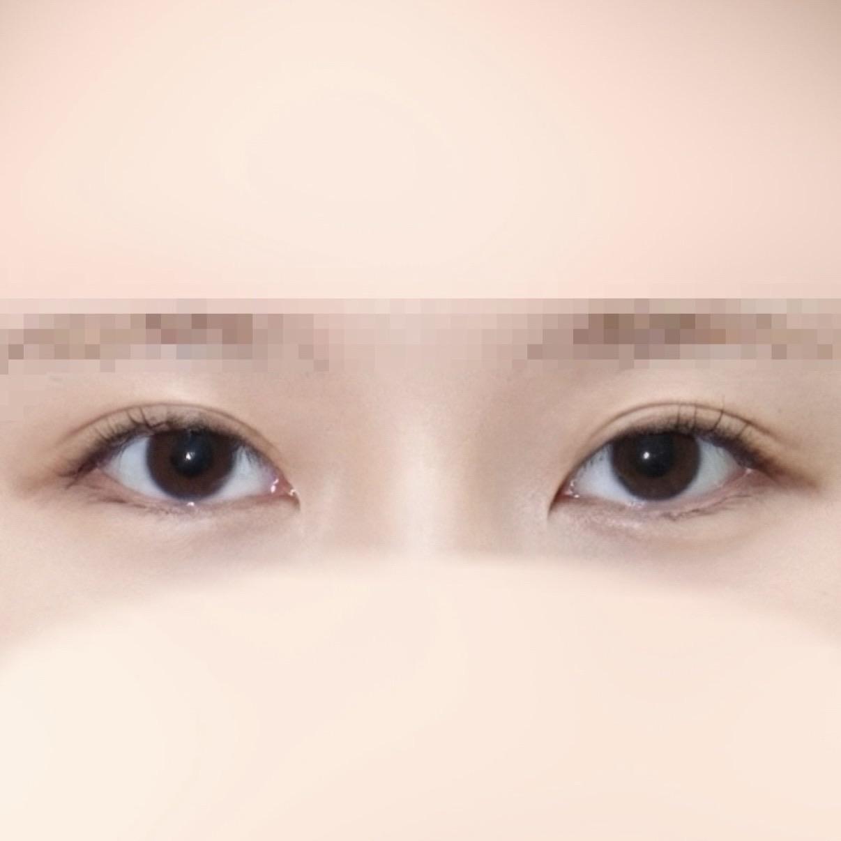後