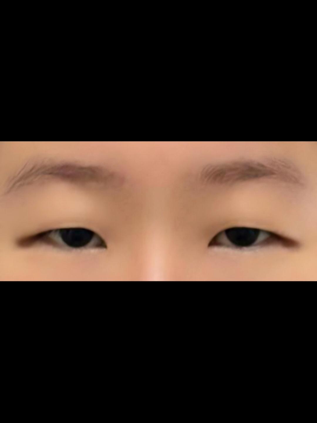 後