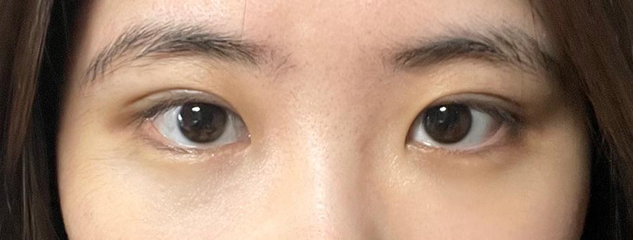 後