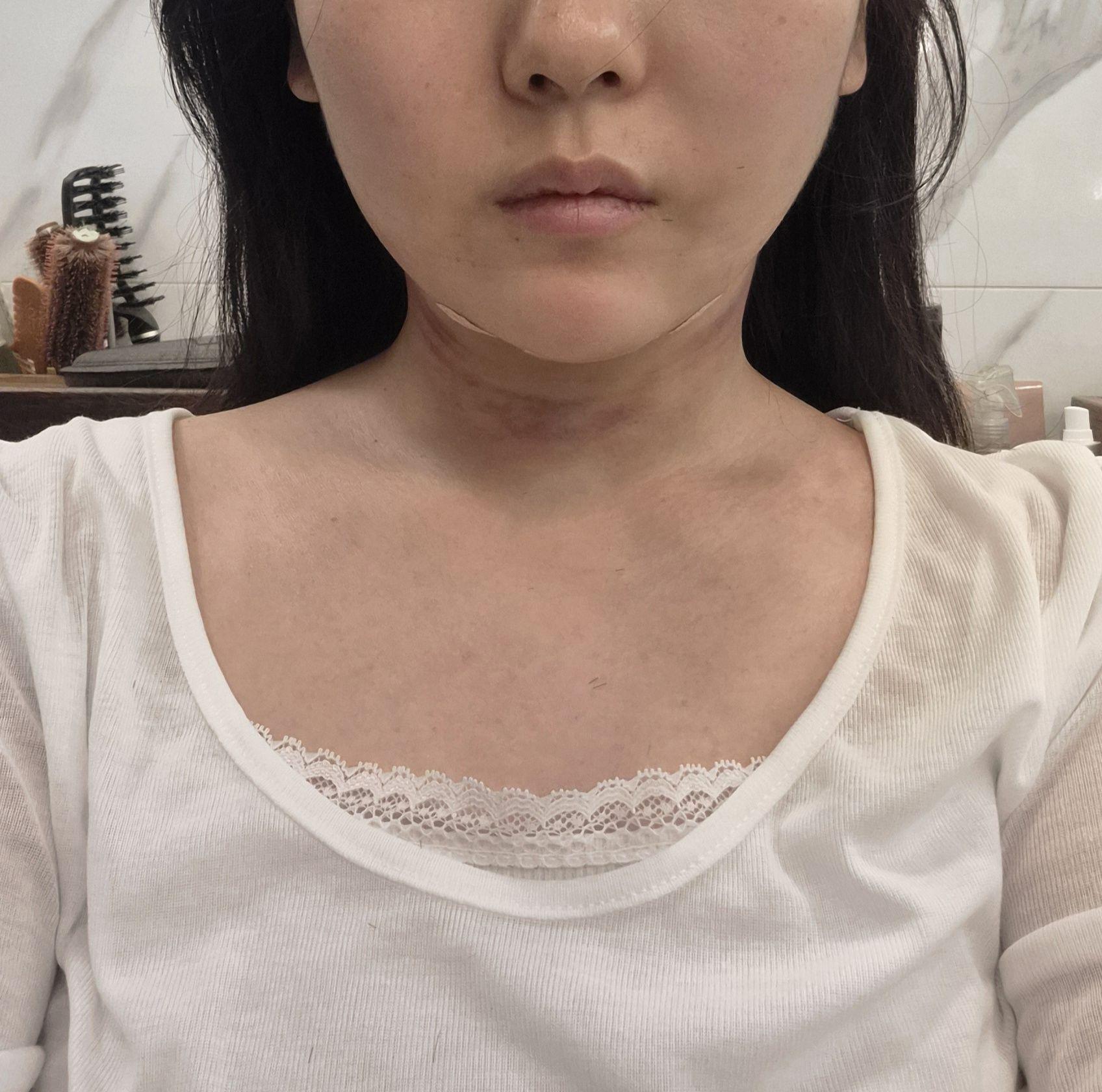 后