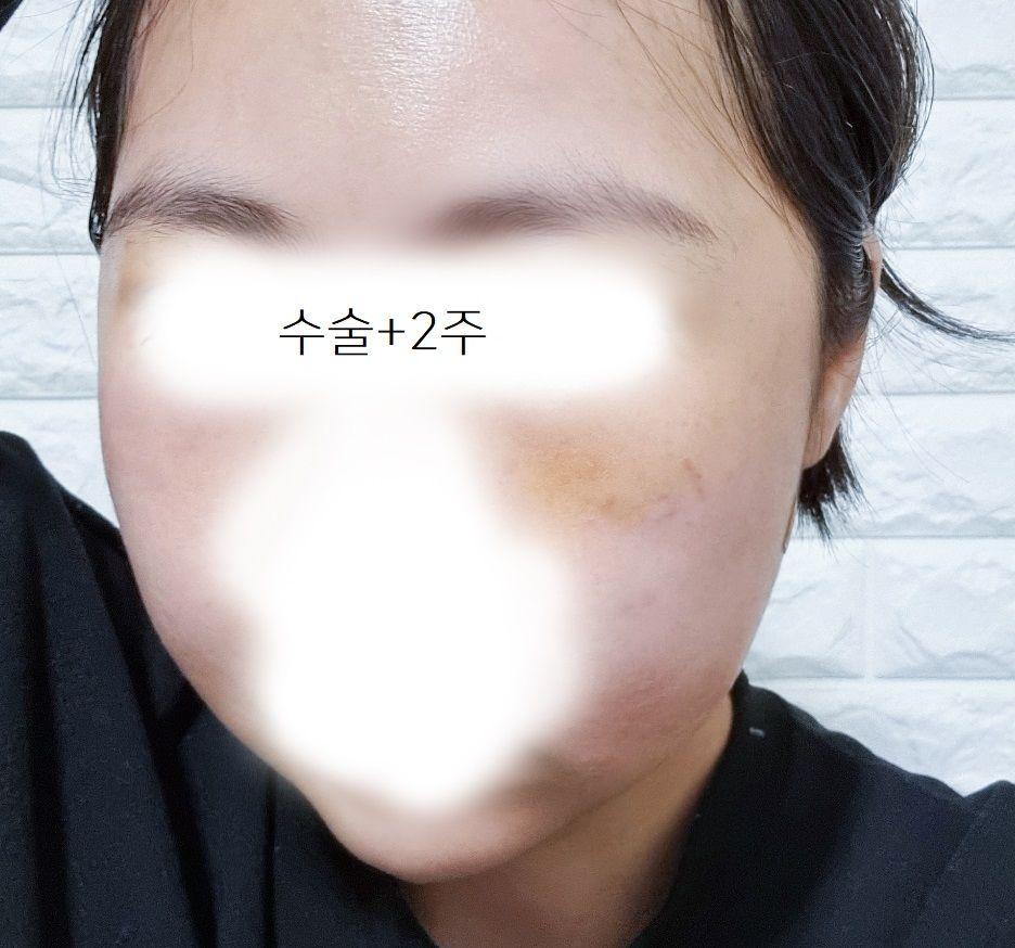 後