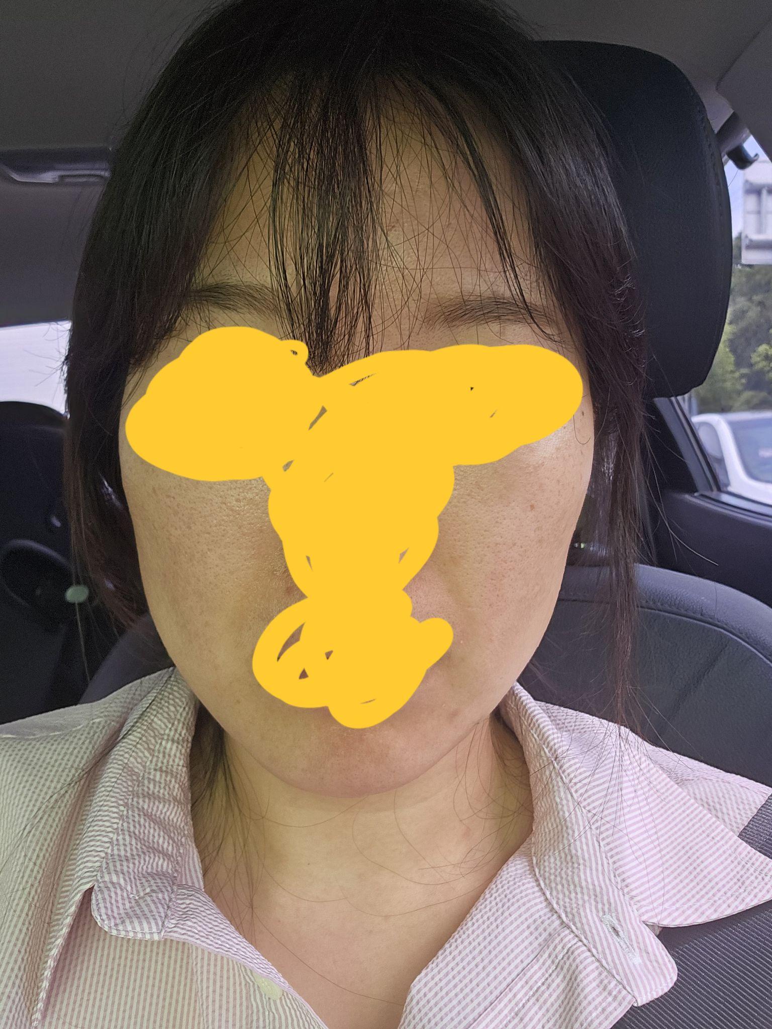 後
