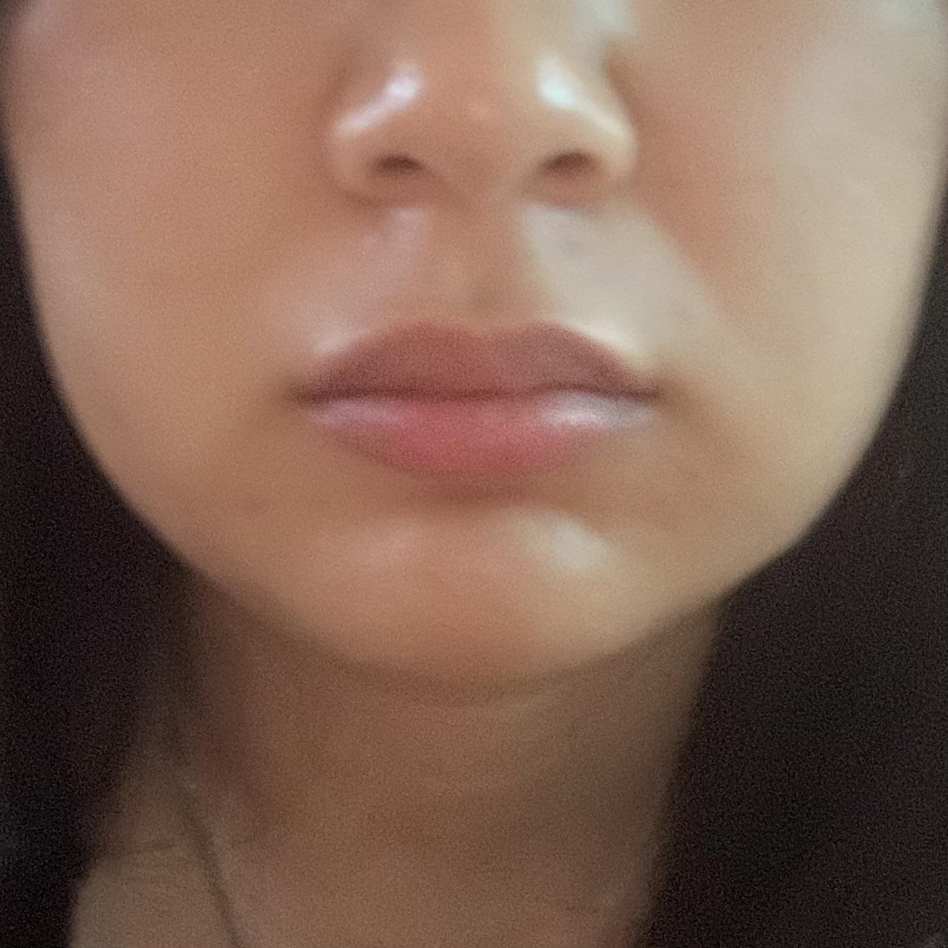 後