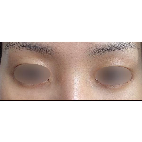 后