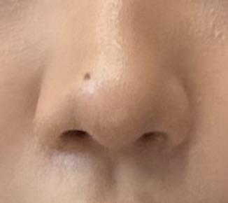 後