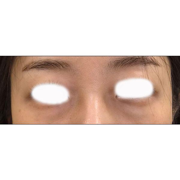 前