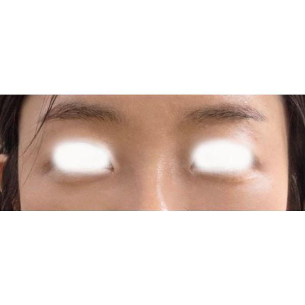后