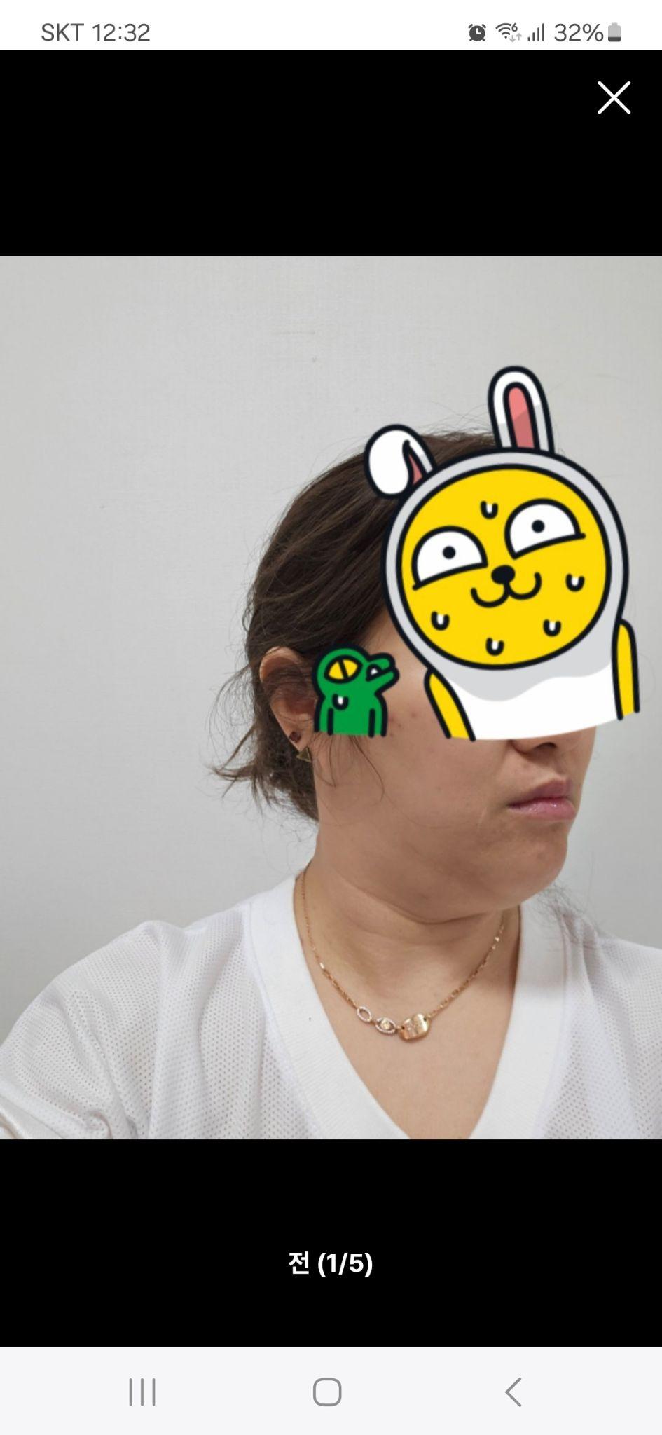 後