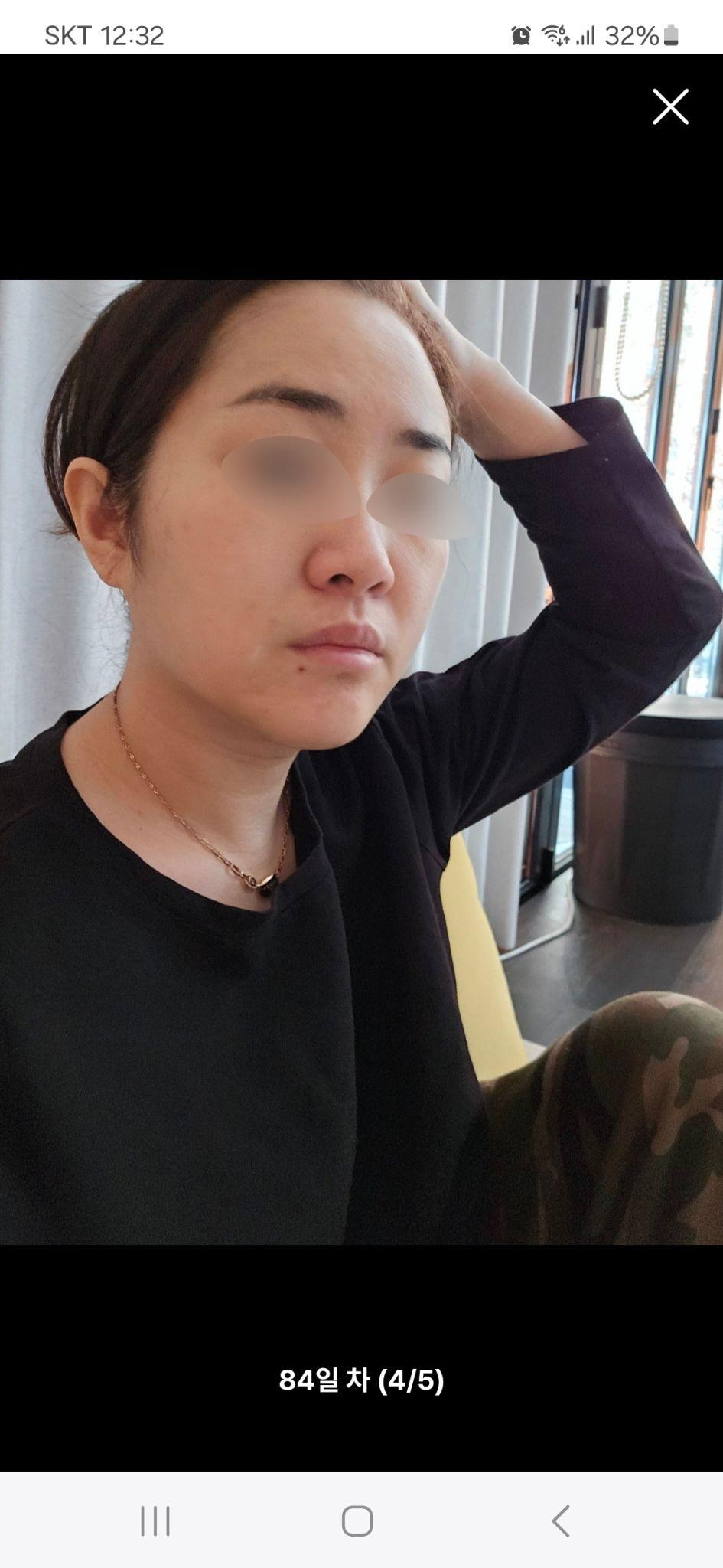 後