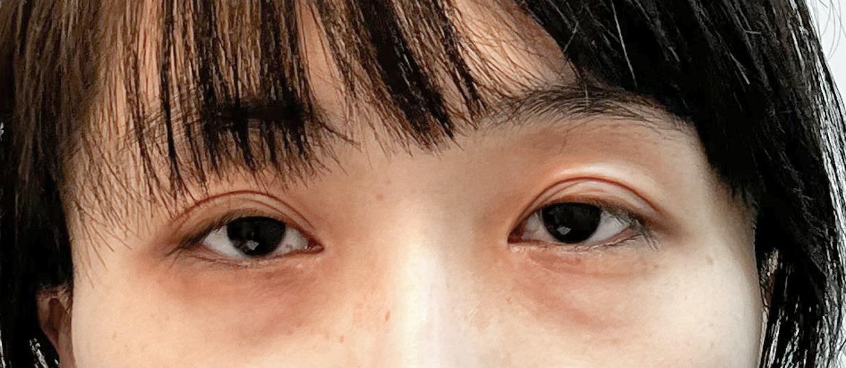 後