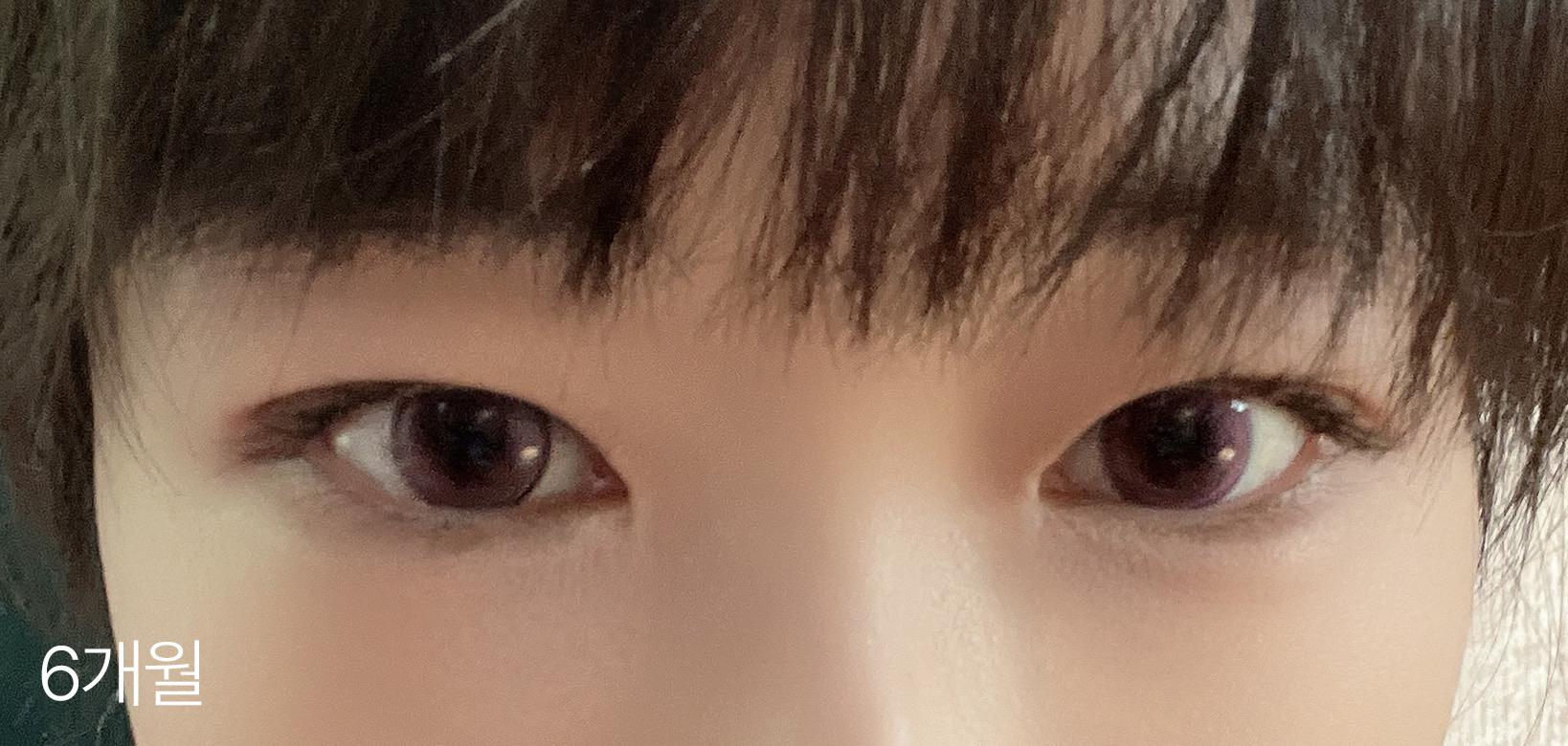 後