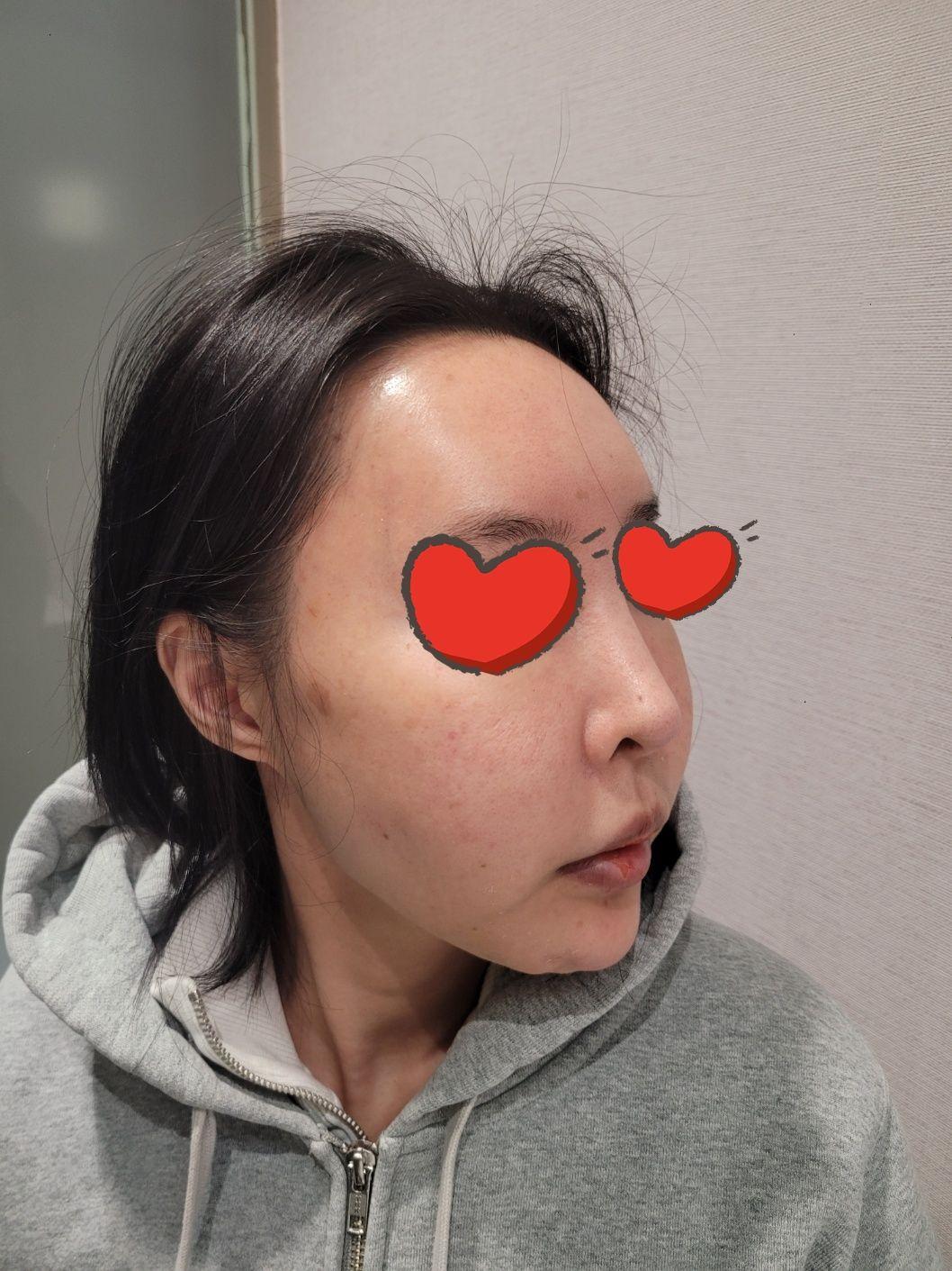 後