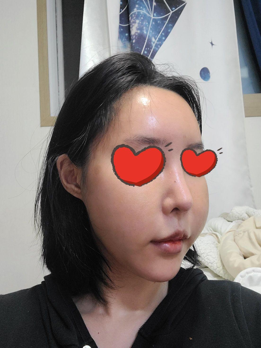 後