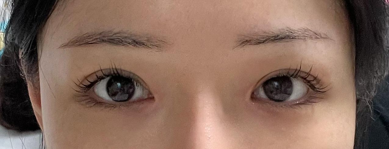 後