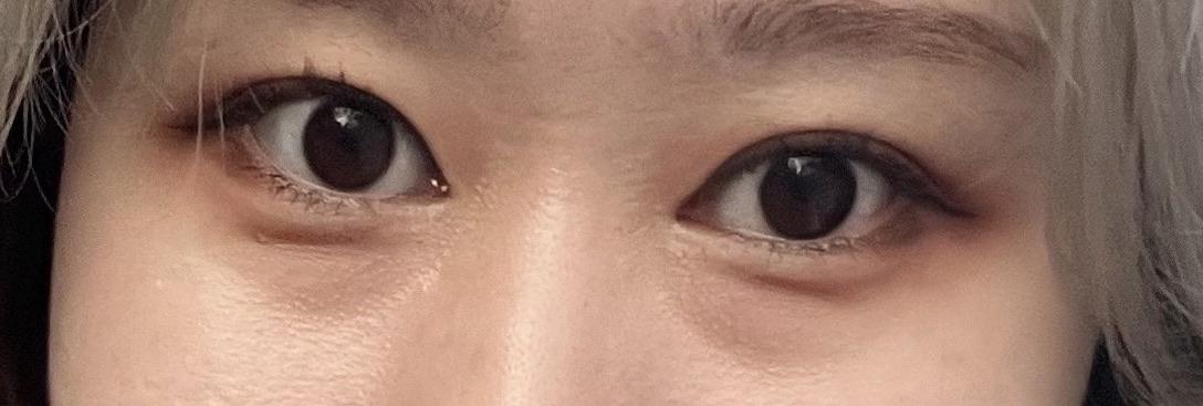 後