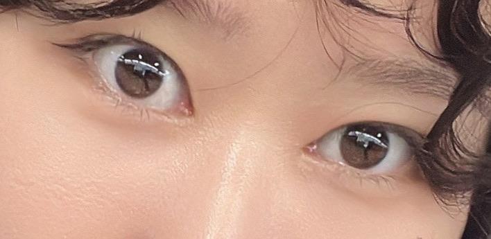 後