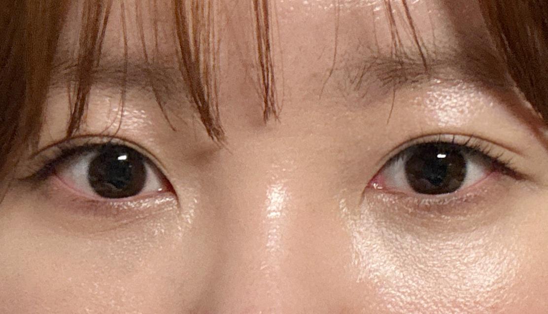 後