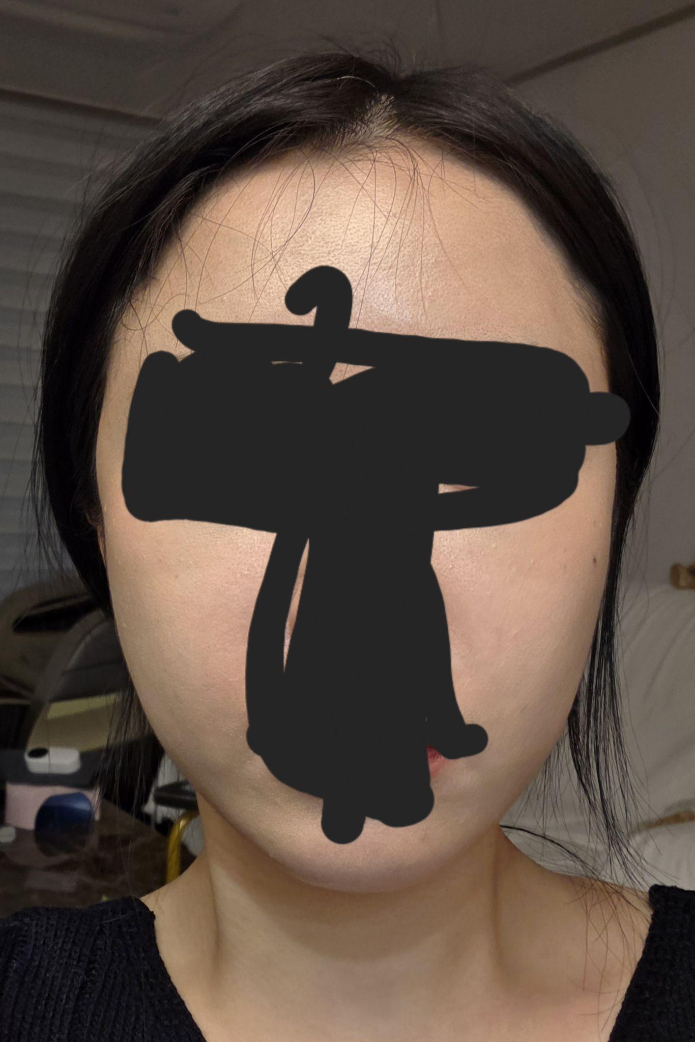 前