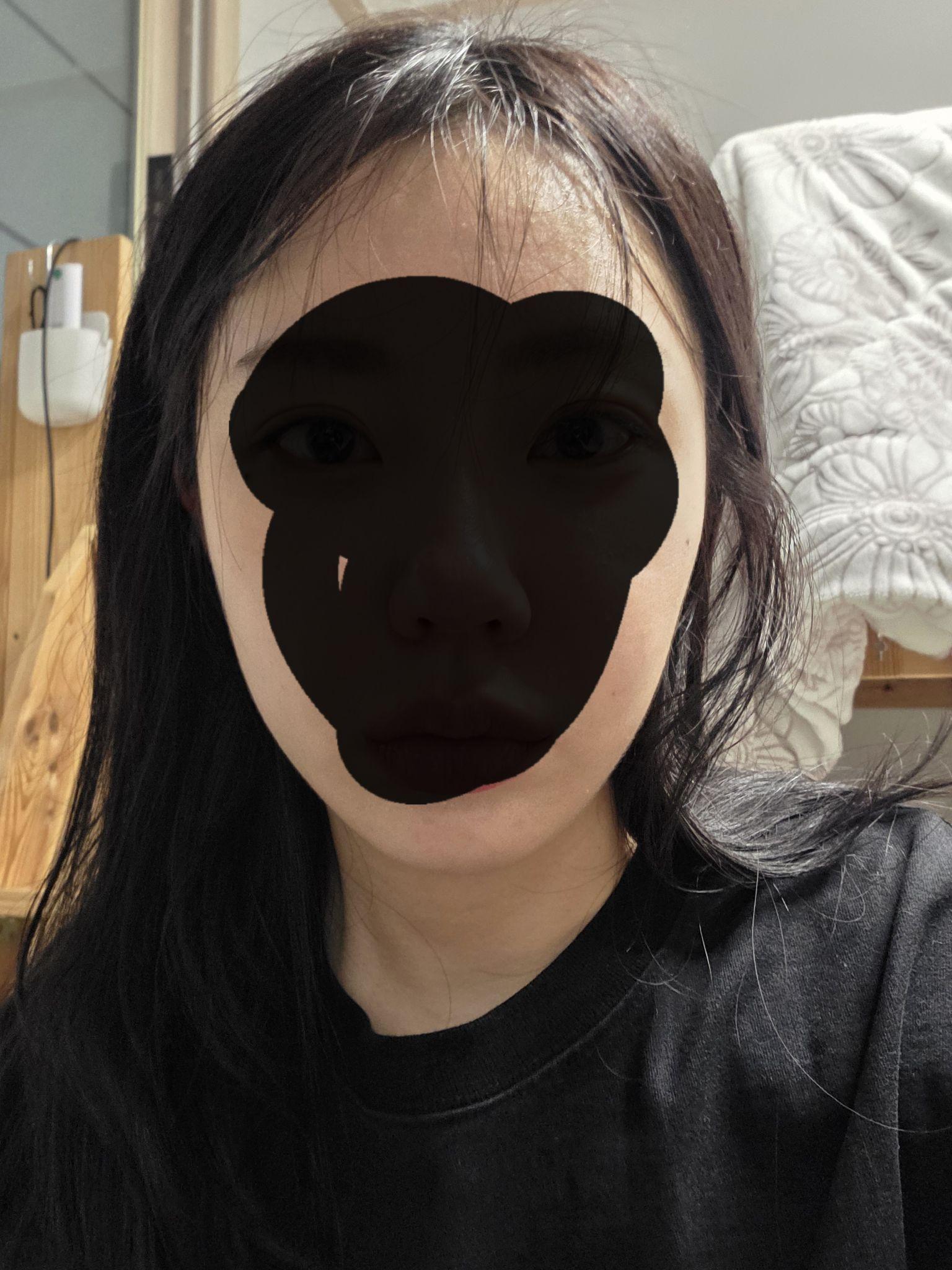 後