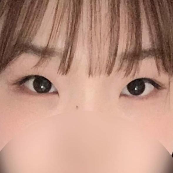 後