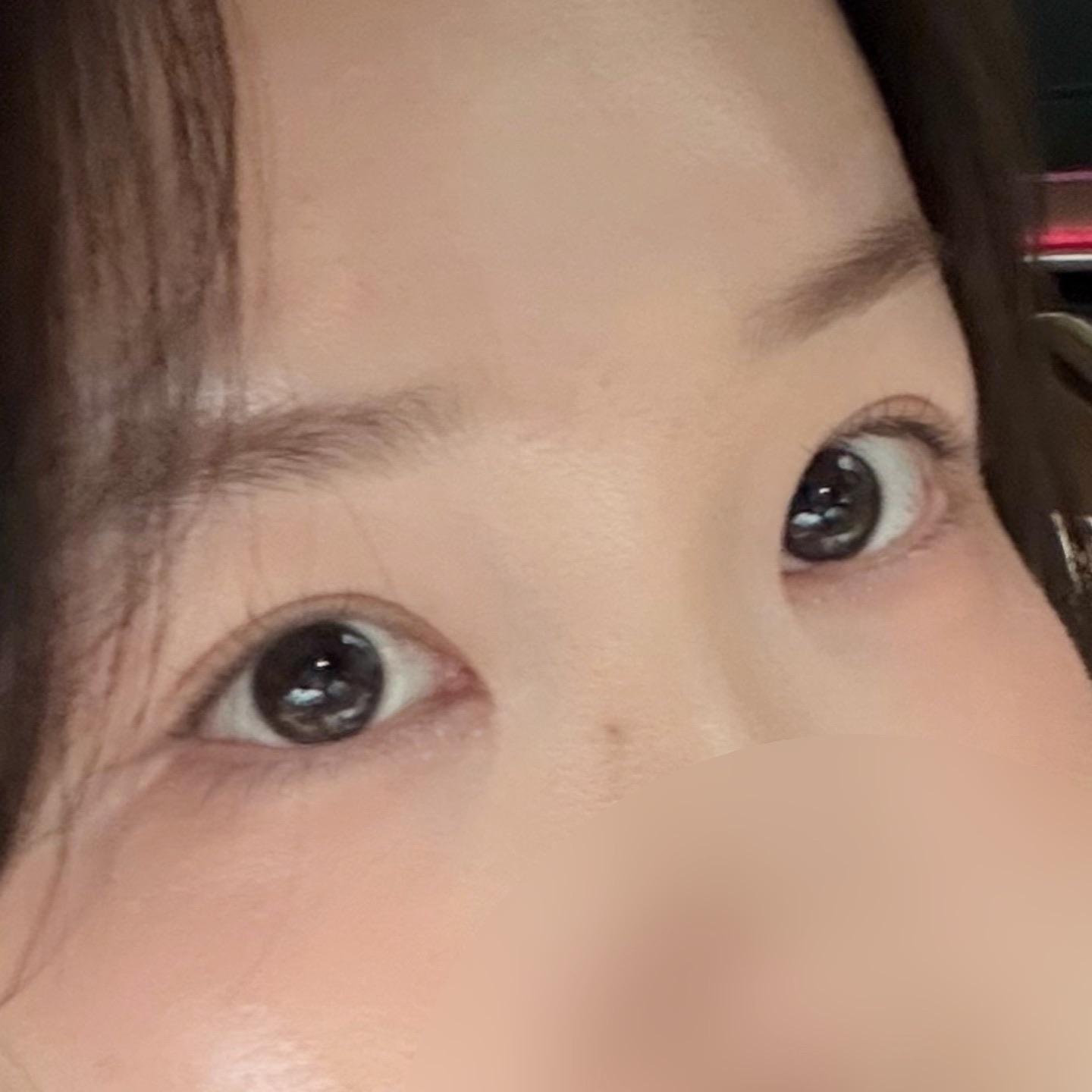 後