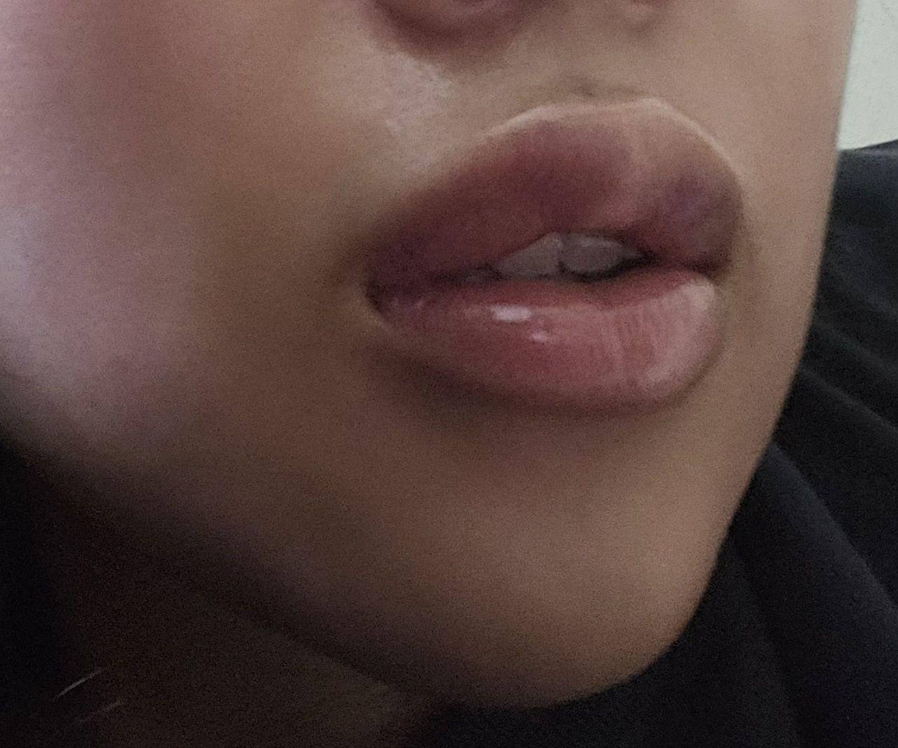後