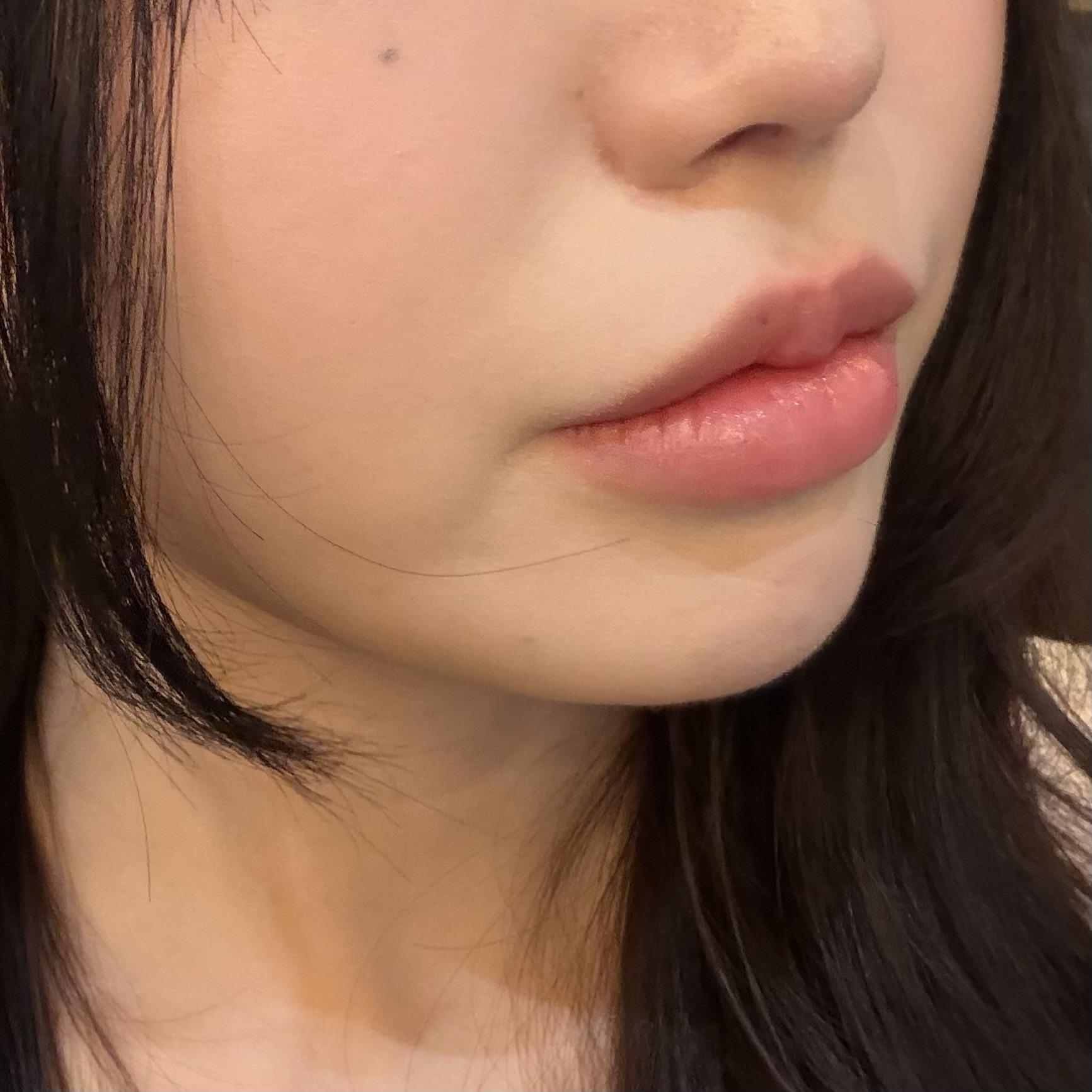 後