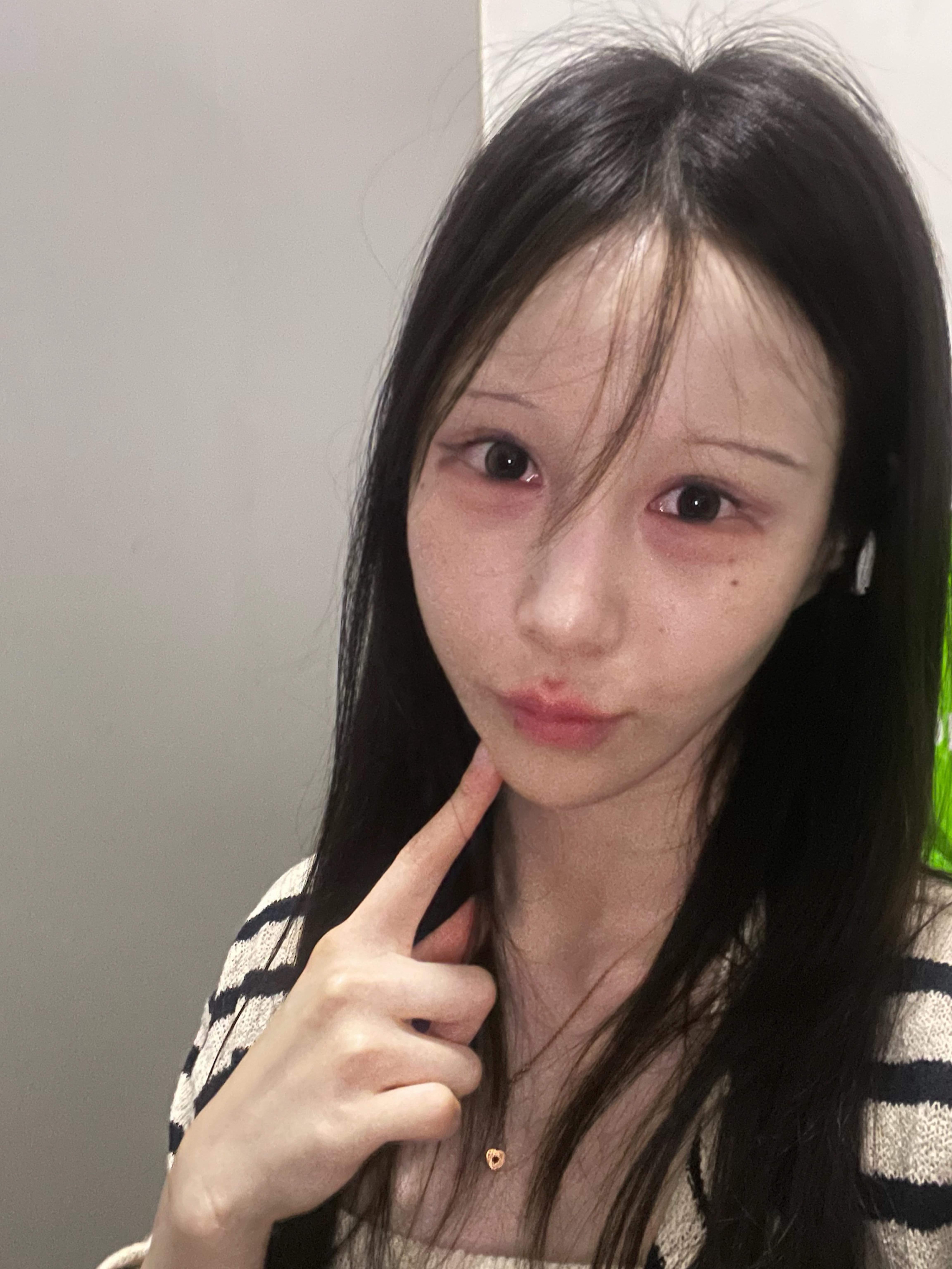 後