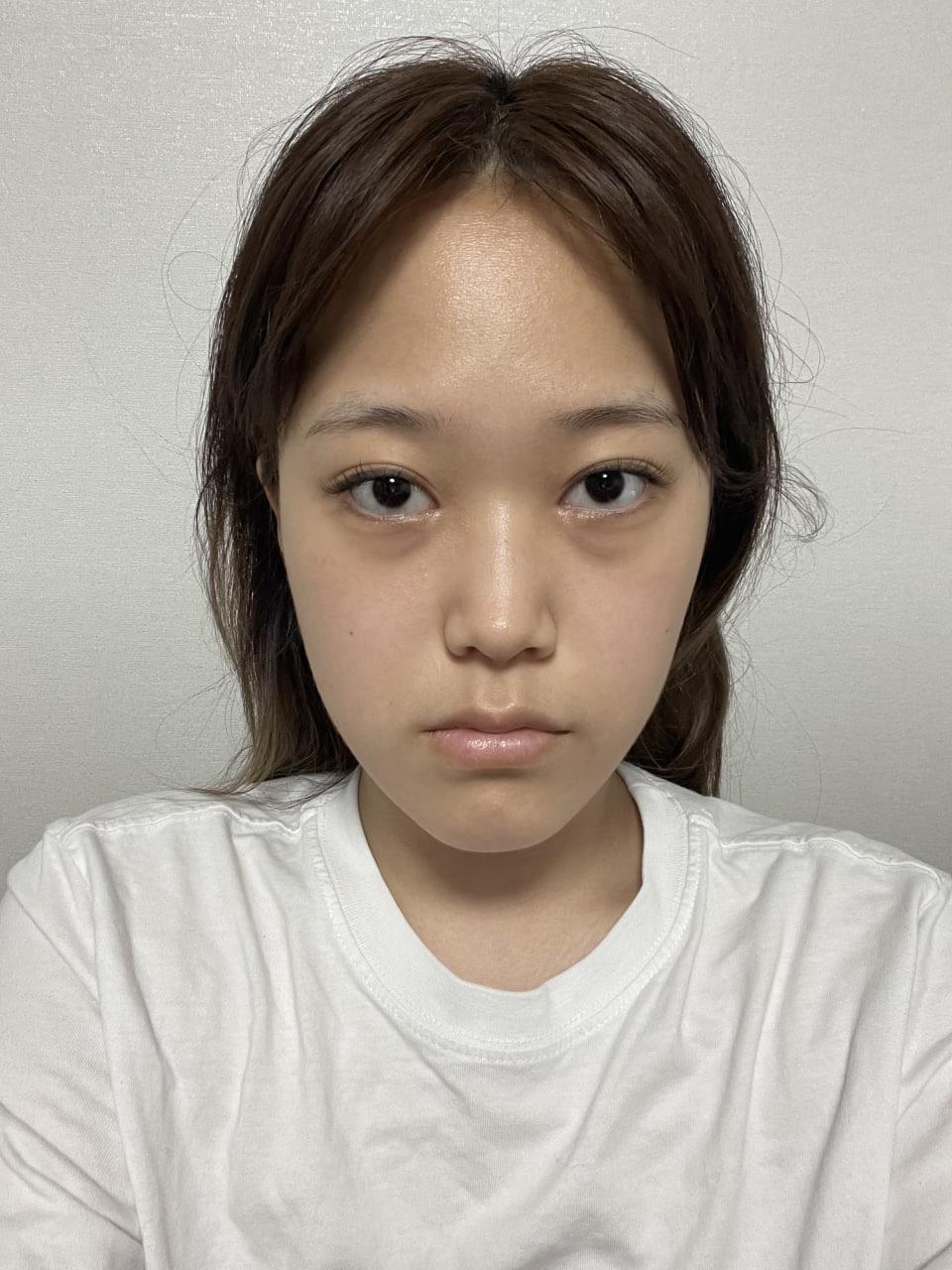 後