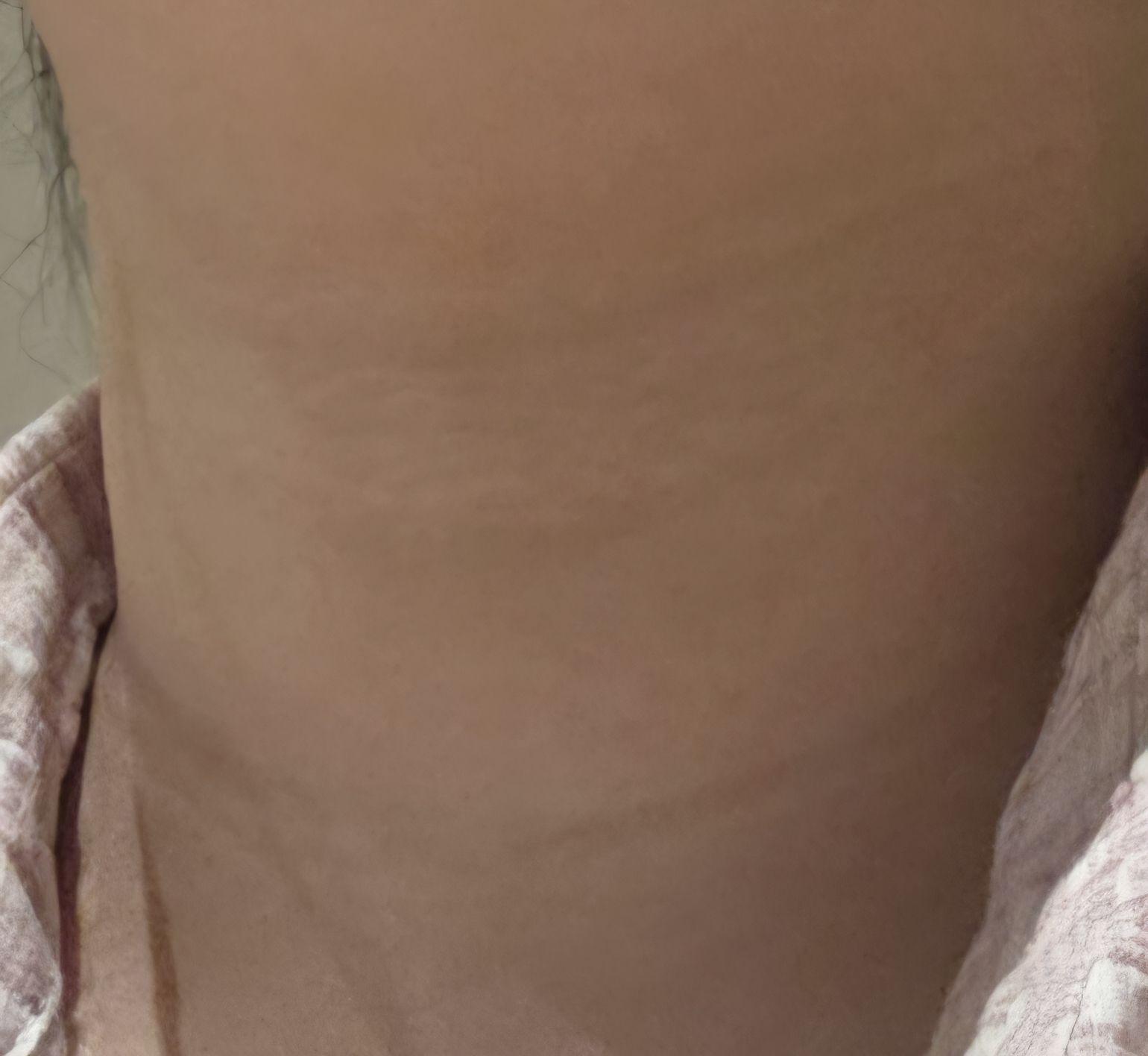 後