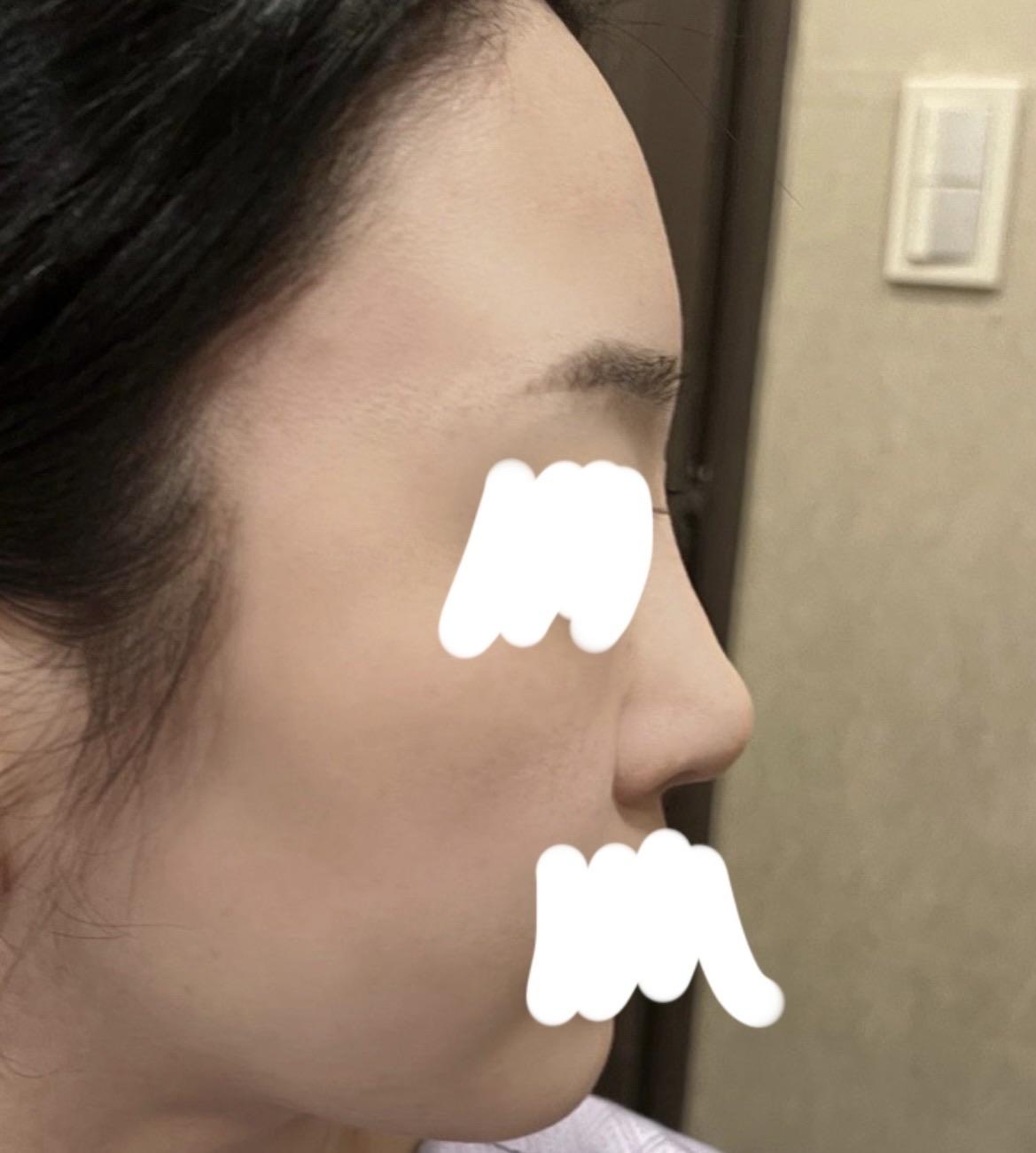 後