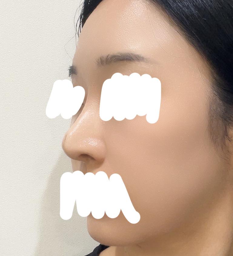 後