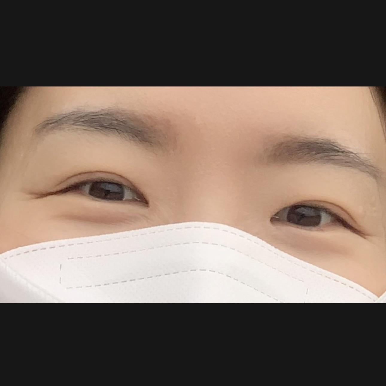 後