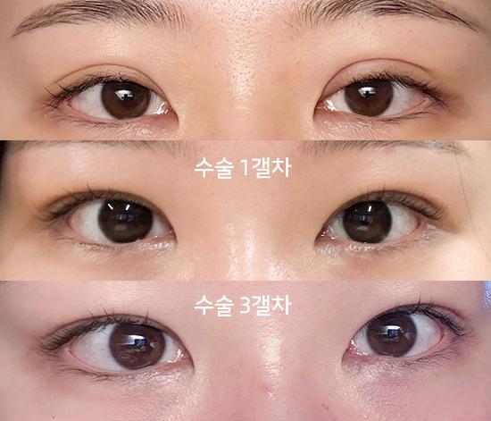 后